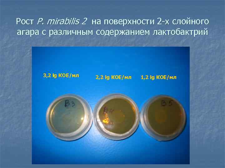 Рост P. mirabilis 2 на поверхности 2 -х слойного агара с различным содержанием лактобактрий