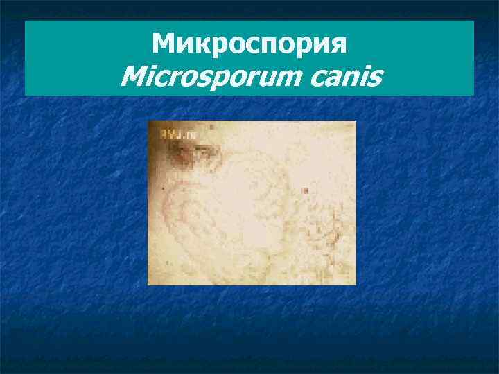Микроспория Microsporum canis 