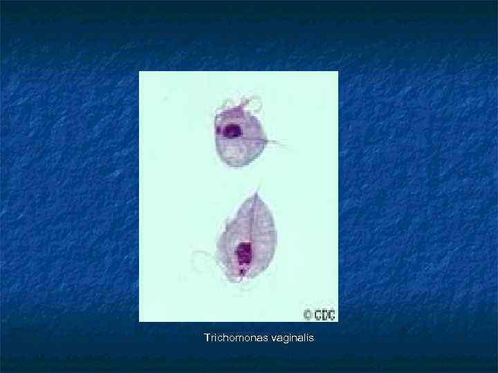 Trichomonas vaginalis 
