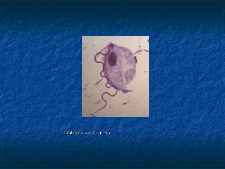 Trichomonas hominis 
