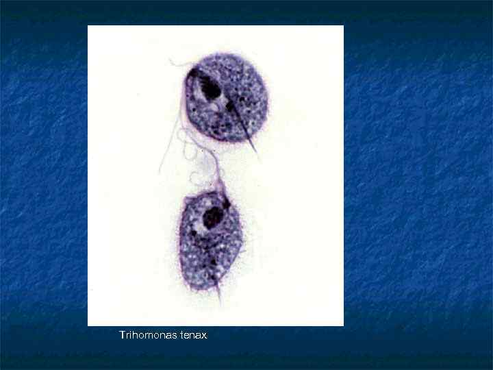 Trihomonas tenax 
