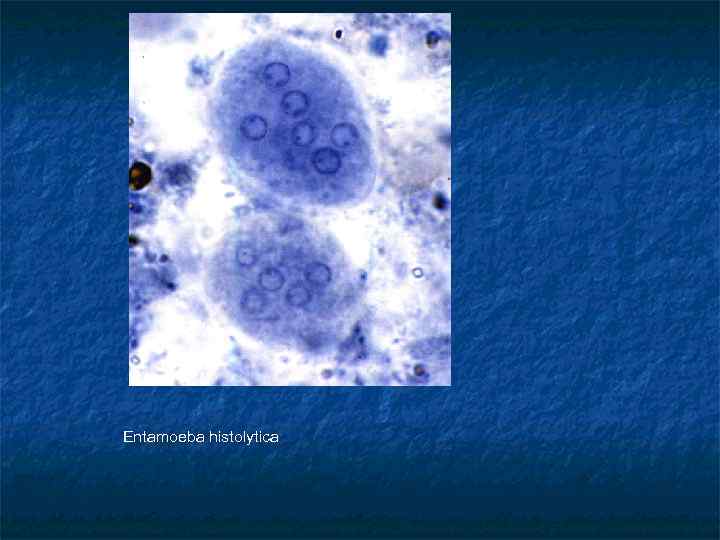 Entamoeba histolytica 