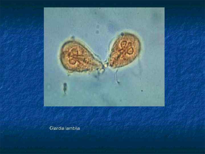 Giardia lamblia 