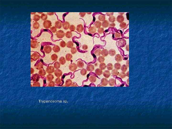 Trypanosoma sp. 