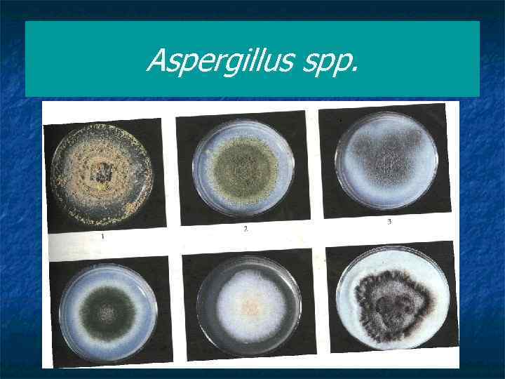 Aspergillus spp. 