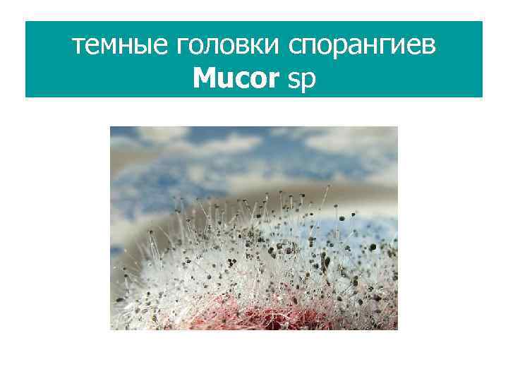темные головки спорангиев Mucor sp 