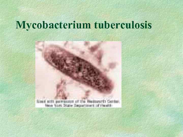 Mycobacterium tuberculosis 