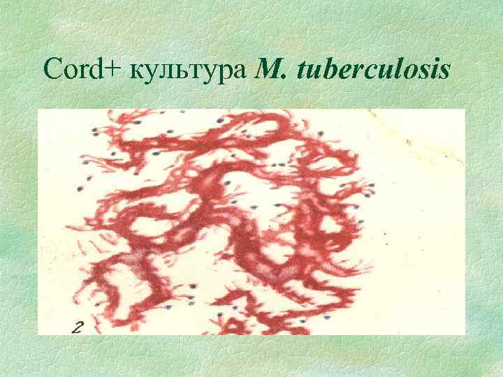 Cord+ культура M. tuberculosis 