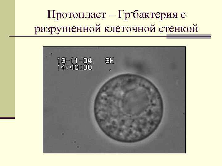 Протопласт – Гр-бактерия с разрушенной клеточной стенкой 