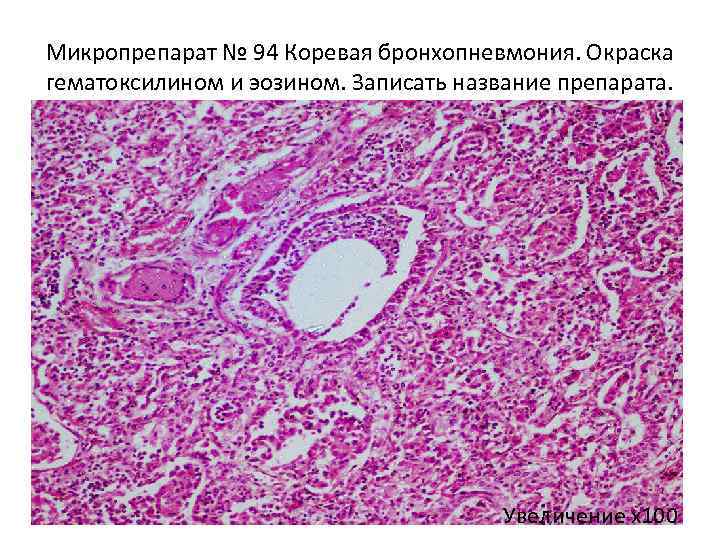 Крупозный трахеит микропрепарат рисунок