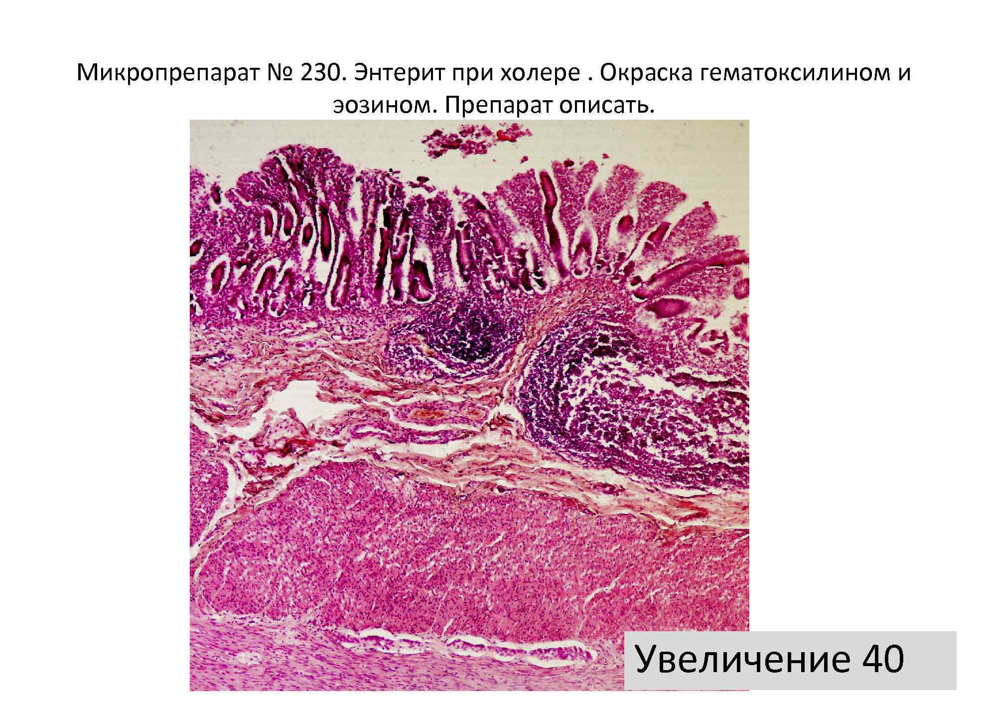 План обследования при холере