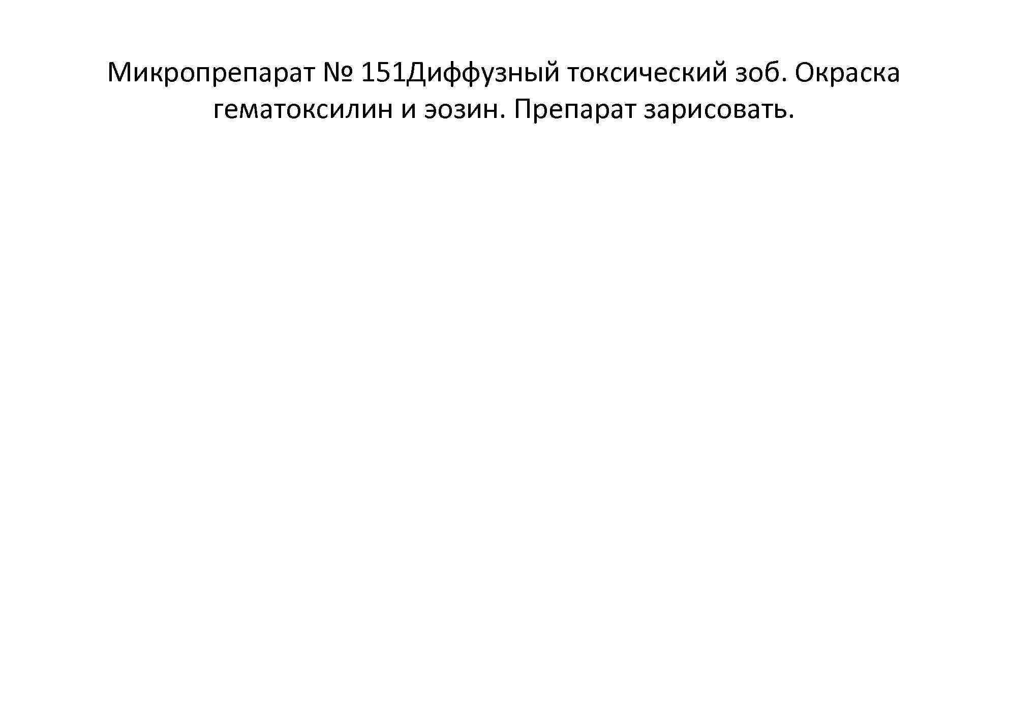Микропрепарат № 151 Диффузный токсический зоб. Окраска гематоксилин и эозин. Препарат зарисовать. 