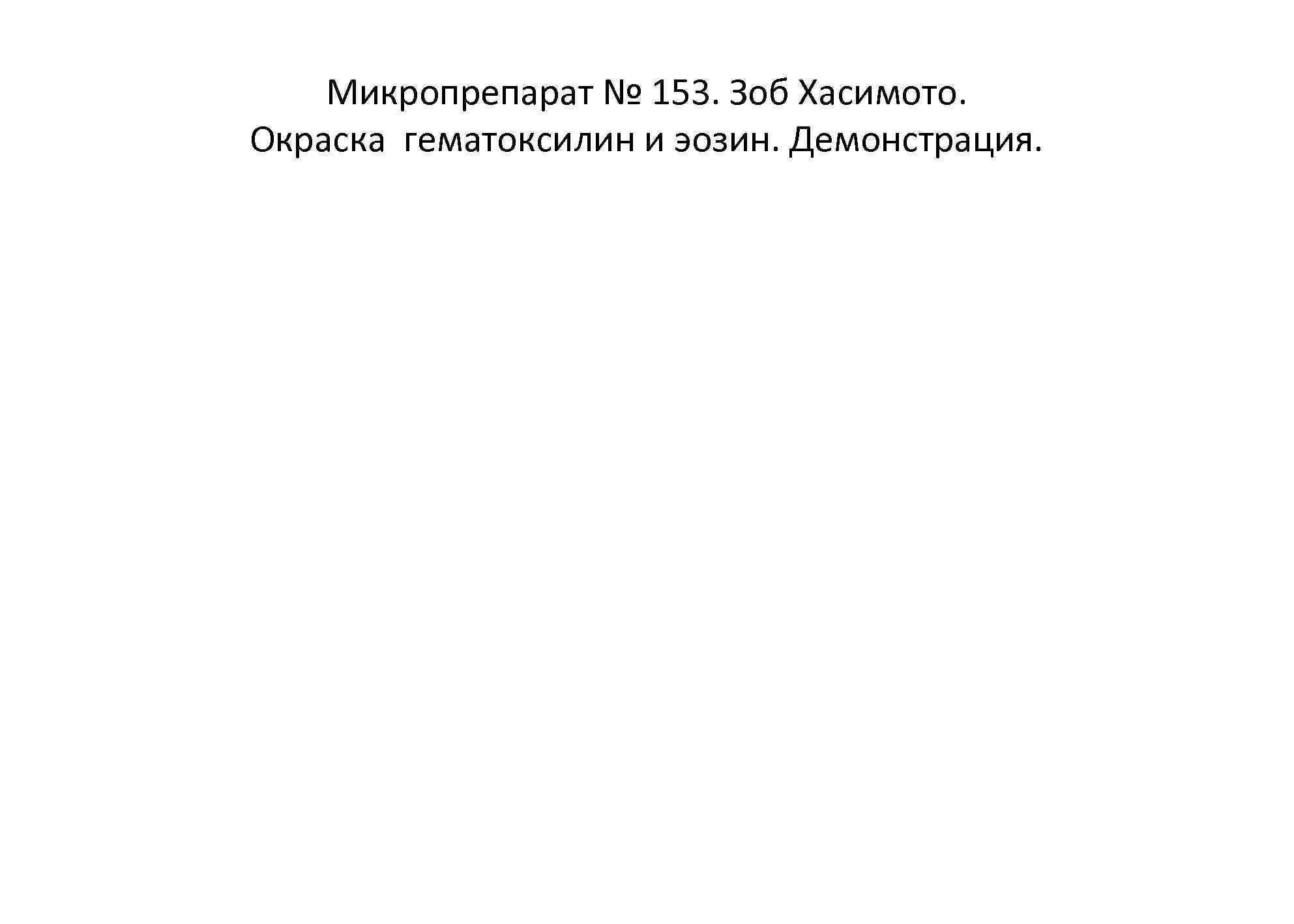 Микропрепарат № 153. Зоб Хасимото. Окраска гематоксилин и эозин. Демонстрация. 