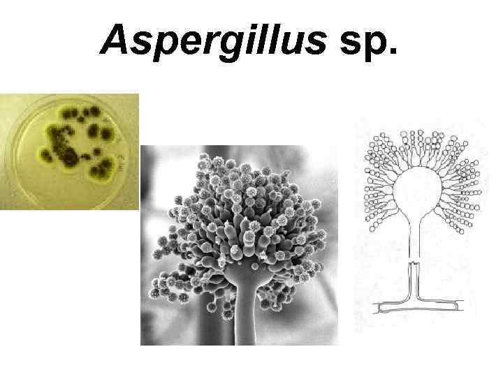 Aspergillus sp. 