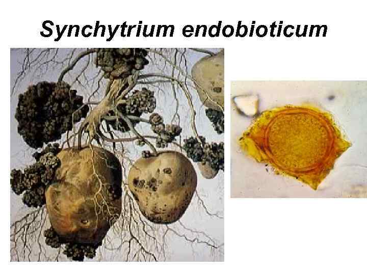 Synchytrium endobioticum 