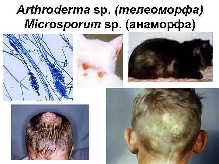 Arthroderma sp. (телеоморфа) Microsporum sp. (анаморфа) 