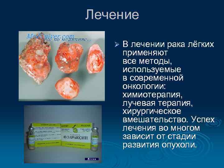 Лечение Ø В лечении рака лёгких применяют все методы, используемые в современной онкологии: химиотерапия,