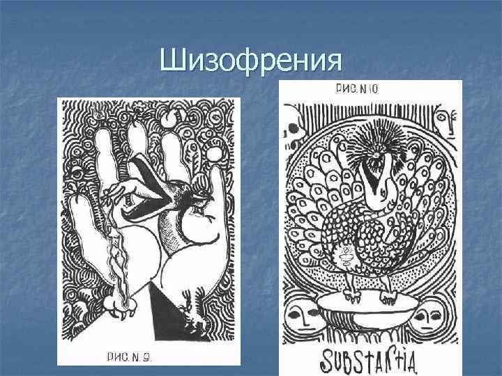 Шизофрения 