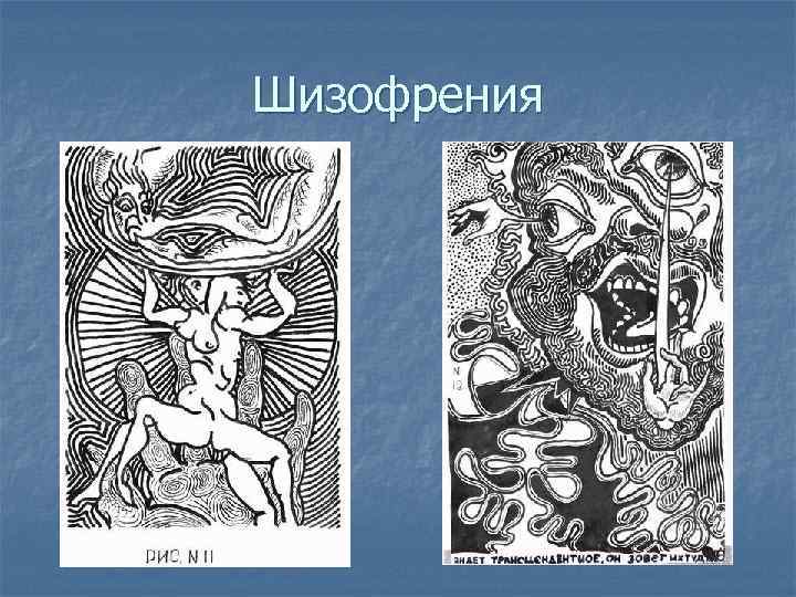 Шизофрения 