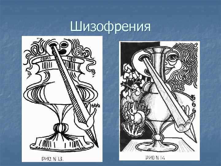 Шизофрения 