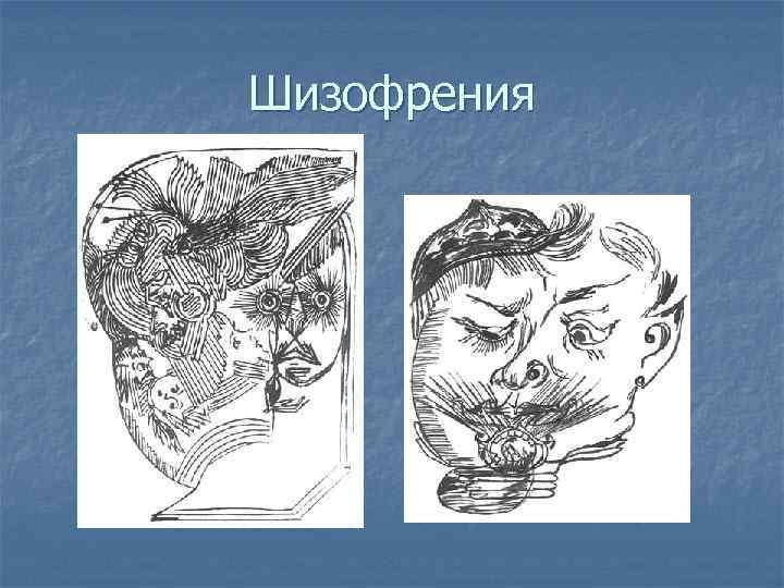 Шизофрения 