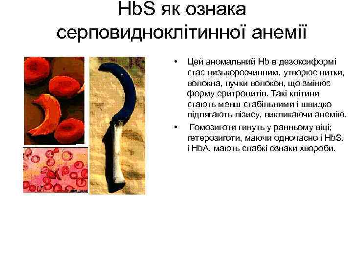 Hb. S як ознака серповидноклітинної анемії • • Цей аномальний Hb в дезоксиформі стає