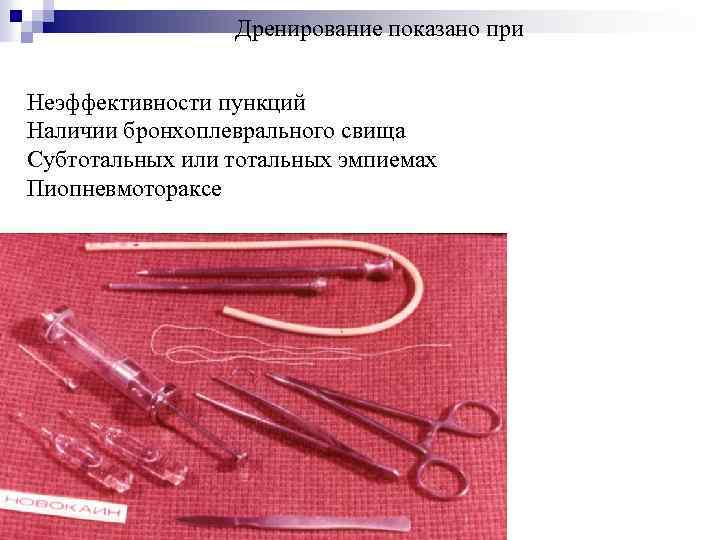 Дренирование показано при Неэффективности пункций Наличии бронхоплеврального свища Субтотальных или тотальных эмпиемах Пиопневмотораксе 