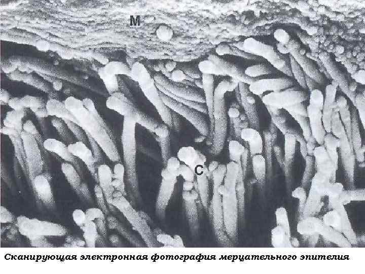 Сканирующая электронная фотография мерцательного эпителия 