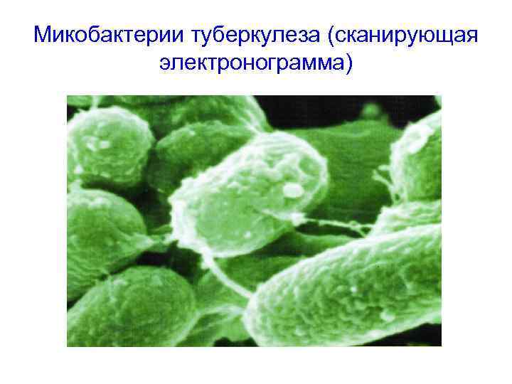 Микобактерии туберкулеза (сканирующая электронограмма) 