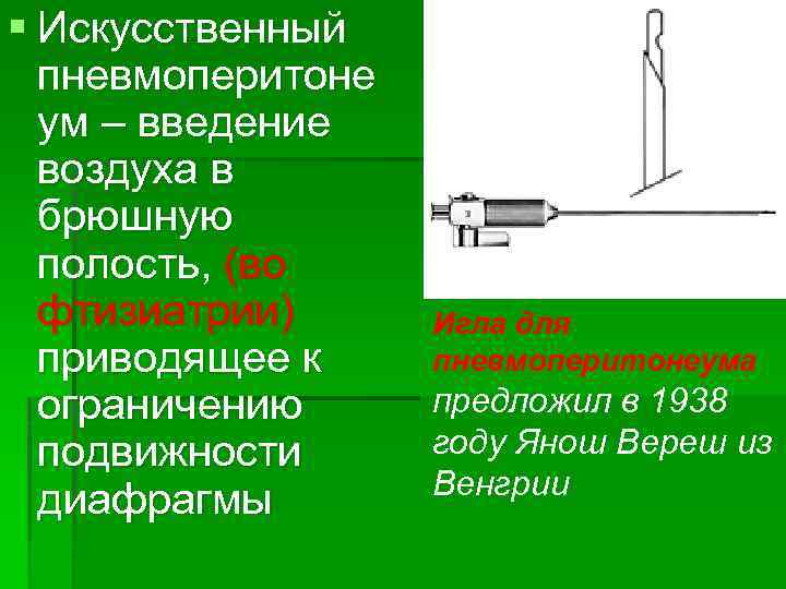 § Искусственный пневмоперитоне ум – введение воздуха в брюшную полость, (во фтизиатрии) приводящее к