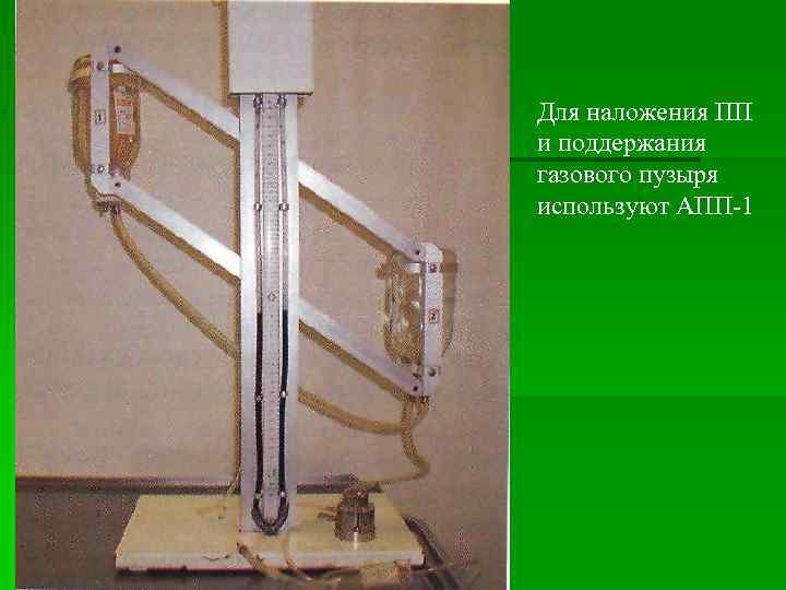 Для наложения ПП и поддержания газового пузыря используют АПП-1 