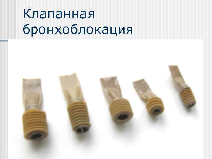 Клапанная бронхоблокация 