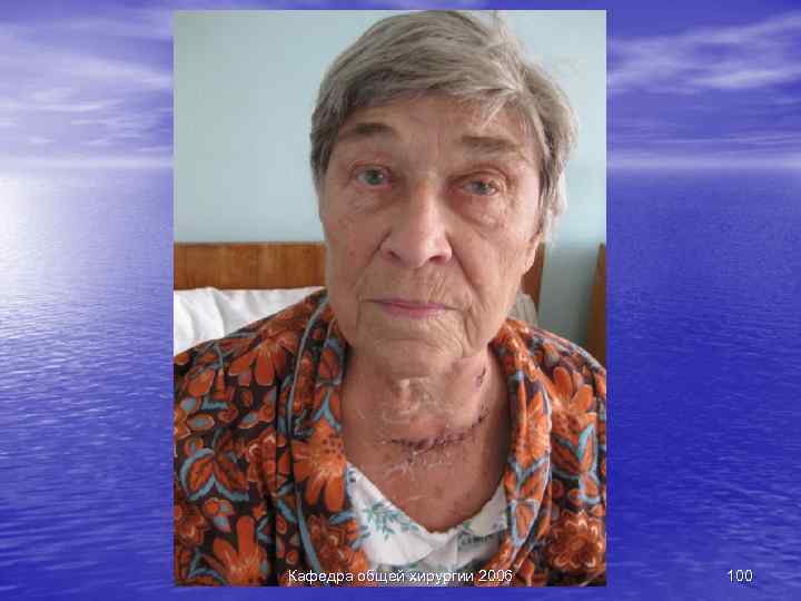 Кафедра общей хирургии 2006 100 