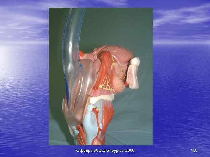 Кафедра общей хирургии 2006 160 