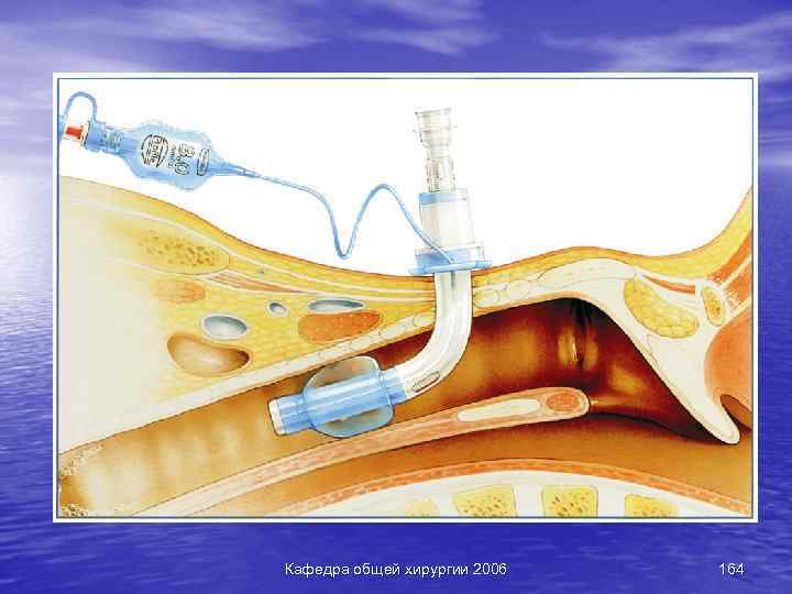 Кафедра общей хирургии 2006 164 