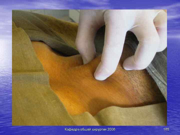 Кафедра общей хирургии 2006 165 