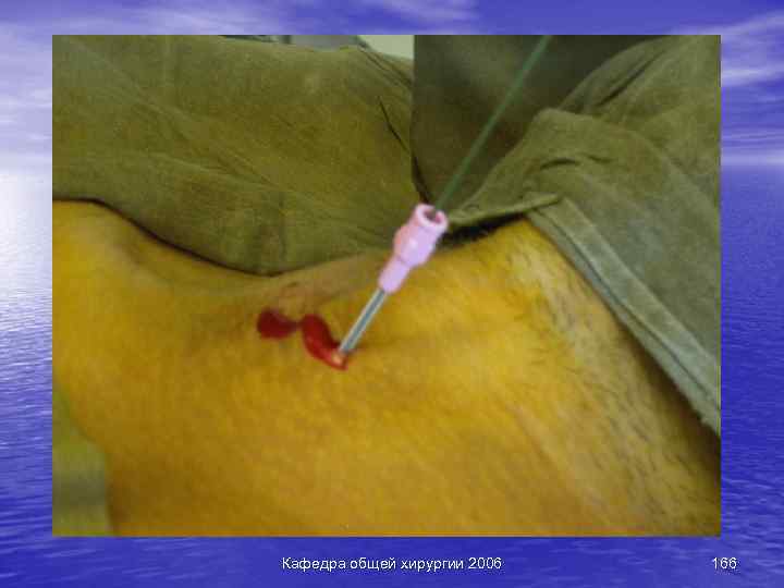 Кафедра общей хирургии 2006 166 