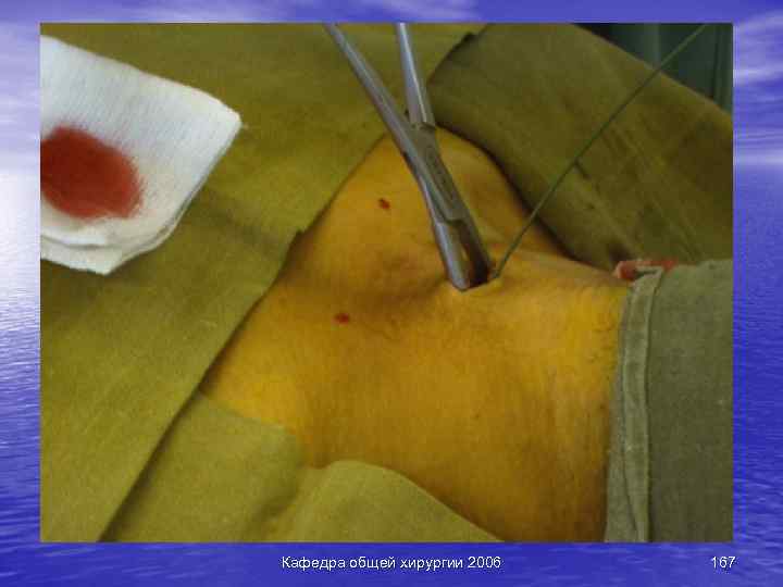 Кафедра общей хирургии 2006 167 