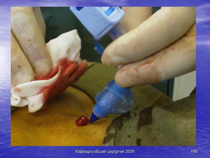 Кафедра общей хирургии 2006 168 