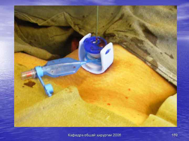 Кафедра общей хирургии 2006 169 
