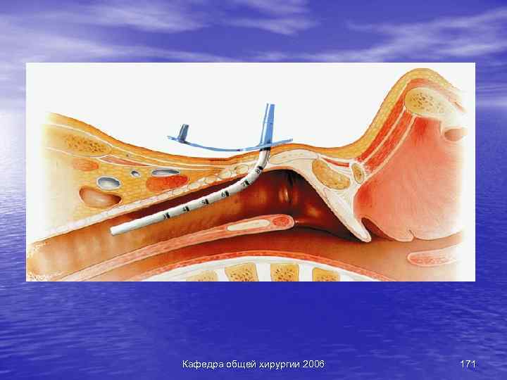 Кафедра общей хирургии 2006 171 