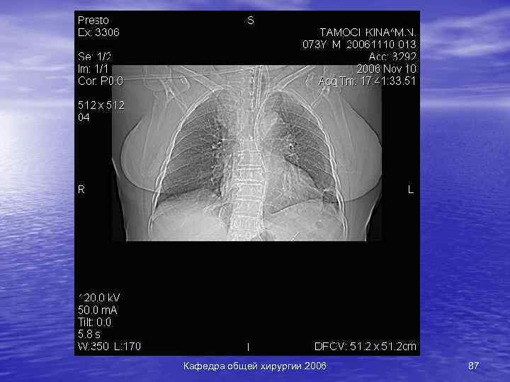 Кафедра общей хирургии 2006 87 