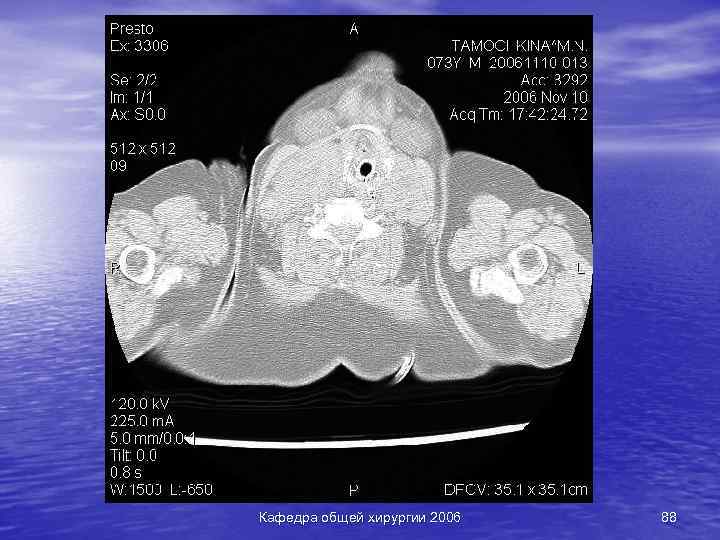 Кафедра общей хирургии 2006 88 