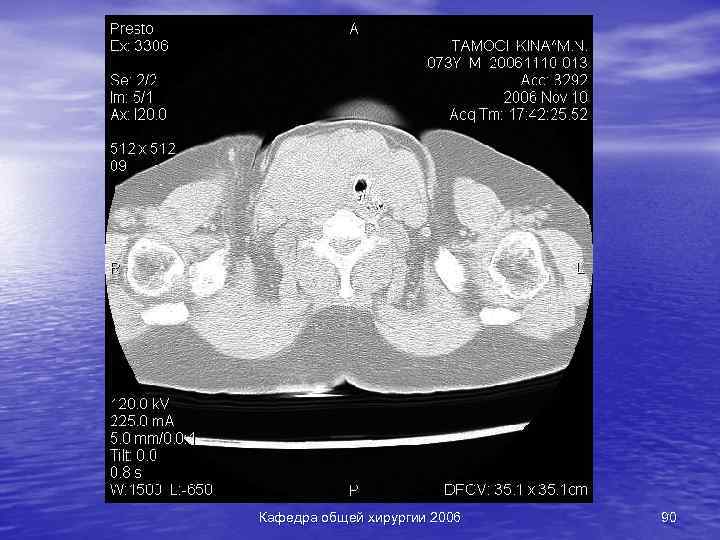 Кафедра общей хирургии 2006 90 