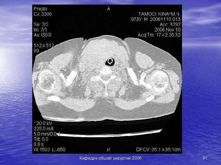 Кафедра общей хирургии 2006 91 