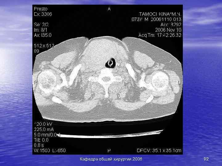 Кафедра общей хирургии 2006 92 