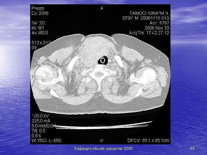 Кафедра общей хирургии 2006 93 