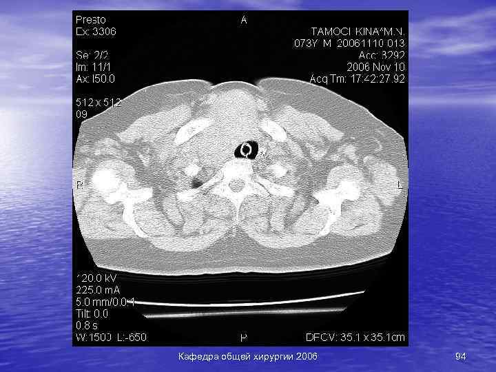 Кафедра общей хирургии 2006 94 