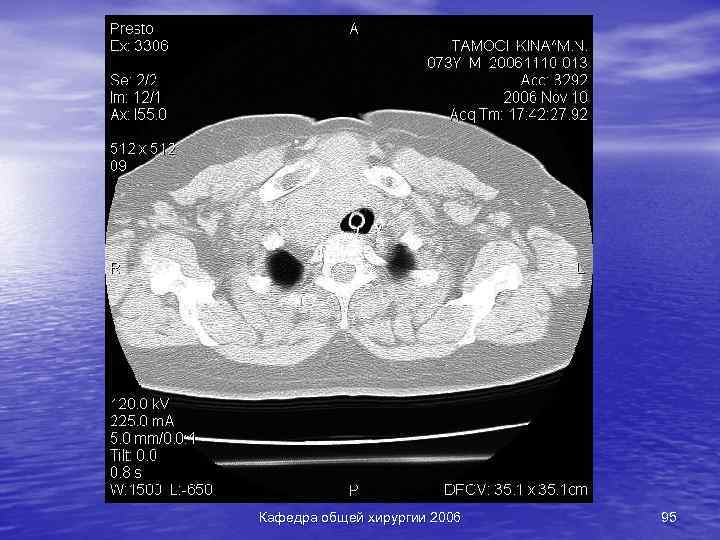 Кафедра общей хирургии 2006 95 