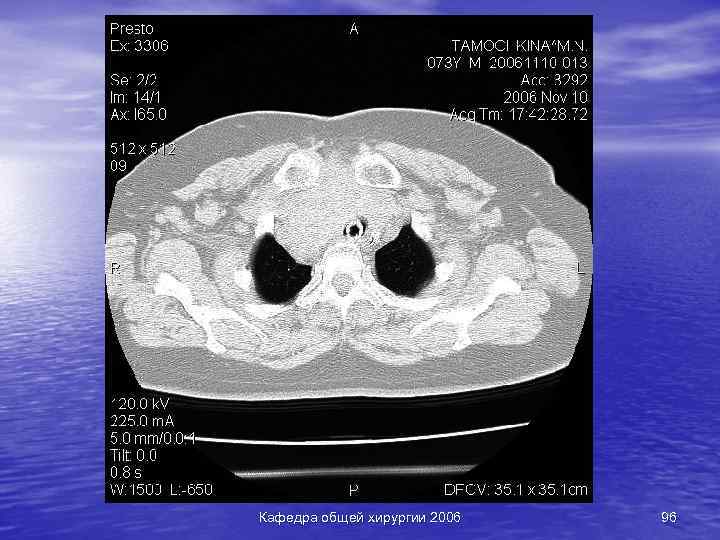 Кафедра общей хирургии 2006 96 